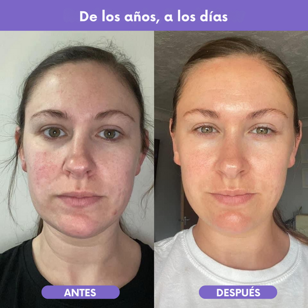 Nutra Glow – Fórmula avanzada para arrugas, cabello y uñas saludables