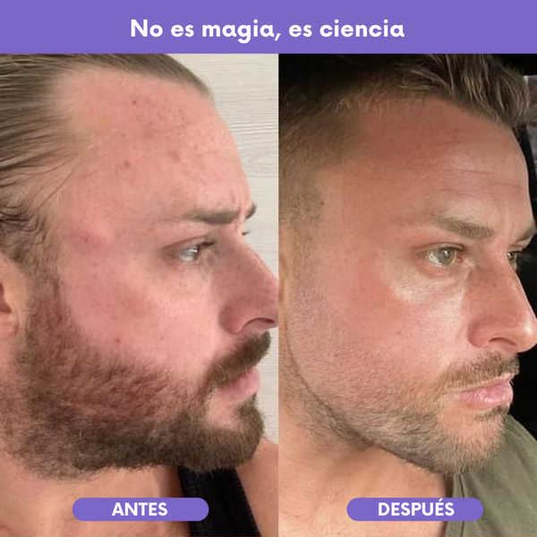 Nutra Glow – Fórmula avanzada para arrugas, cabello y uñas saludables